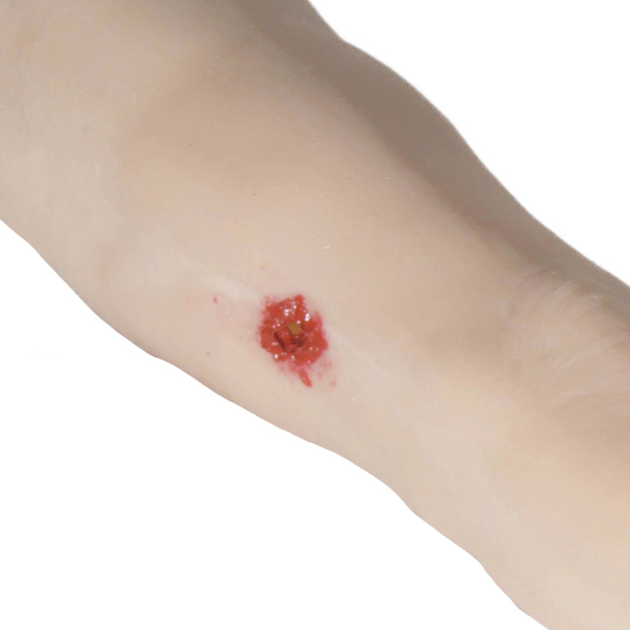 Advanced Trauma Arm Task Trainer