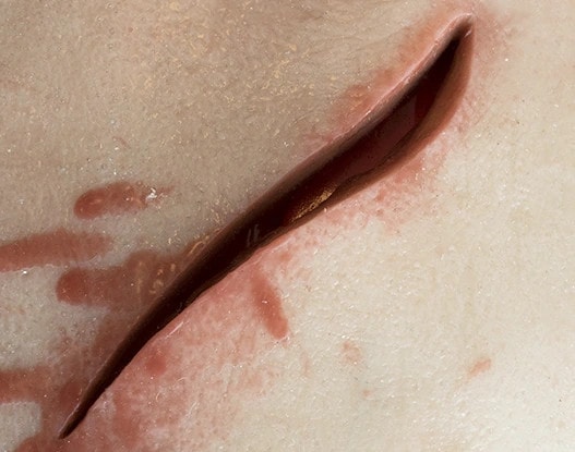 Wearable Suture Practice Arm Sleeve Trainer