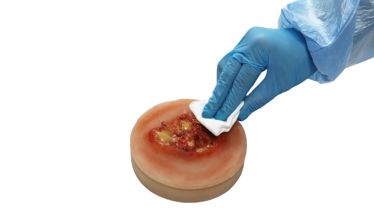 Decubitus Stage 3 Ulcer Care Task Trainer