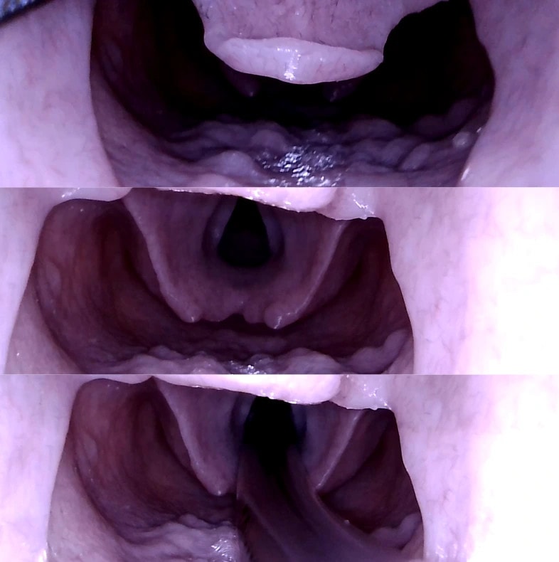 Airway Management Task Trainer V2