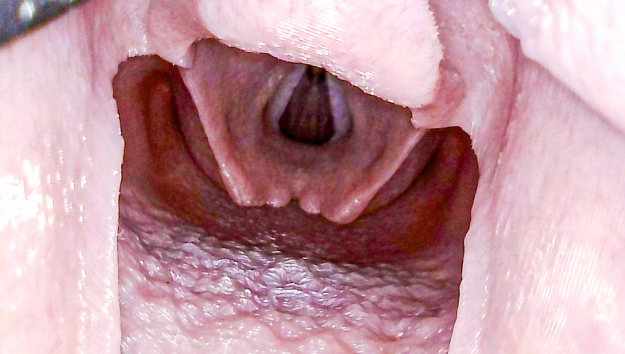 Airway Management Task Trainer V2