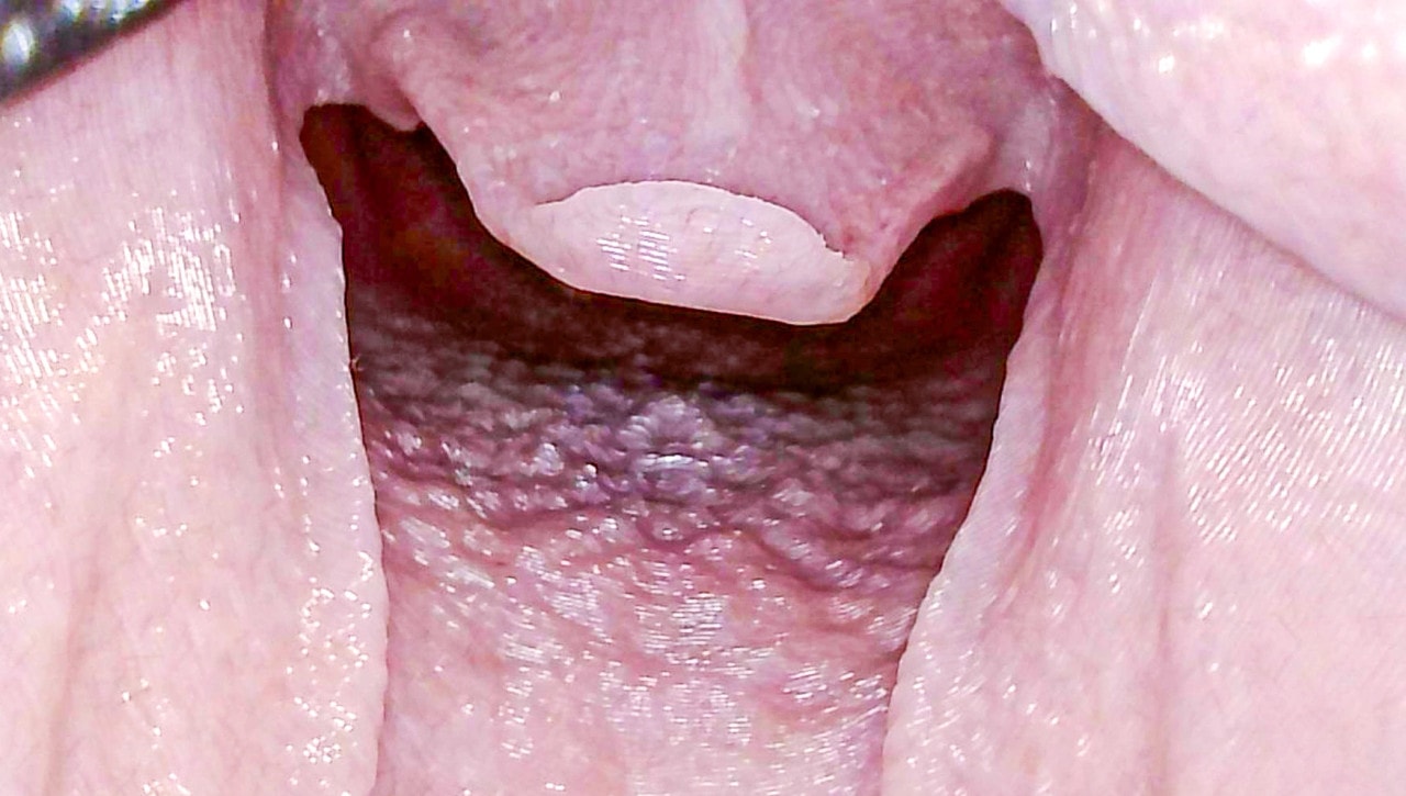 Airway Management Task Trainer V2