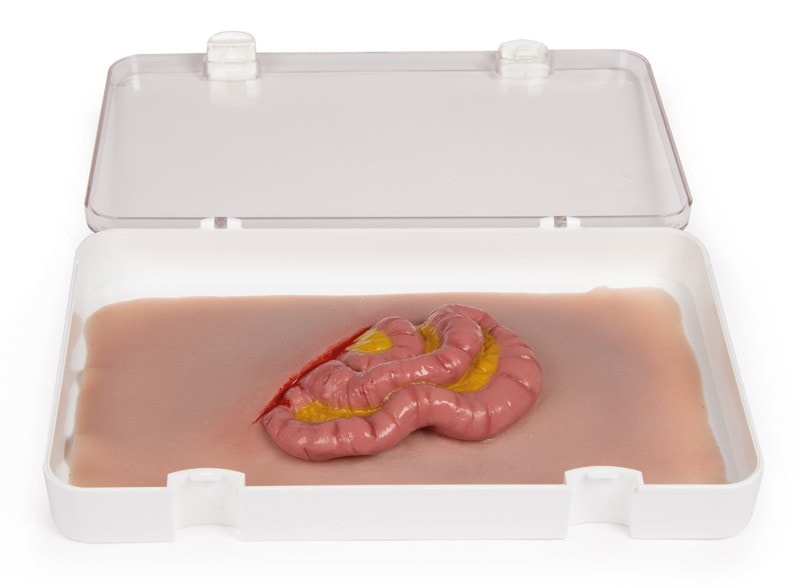 Skin Moulage, Protrusion of Small Intestines