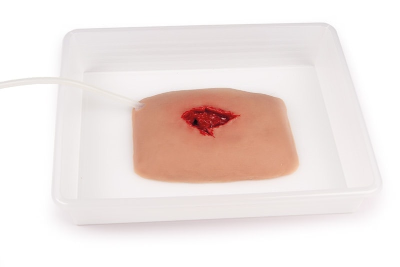 Large Wound Moulage for Wound Packing