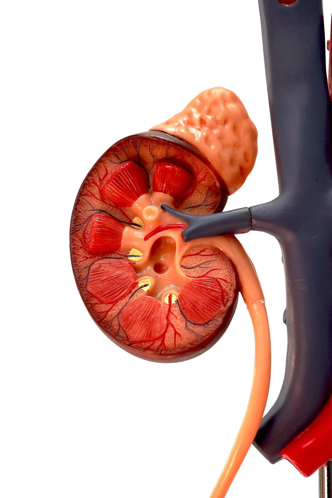 Axis Scientific Free Standing Urinary System, Life Size - 3 Parts