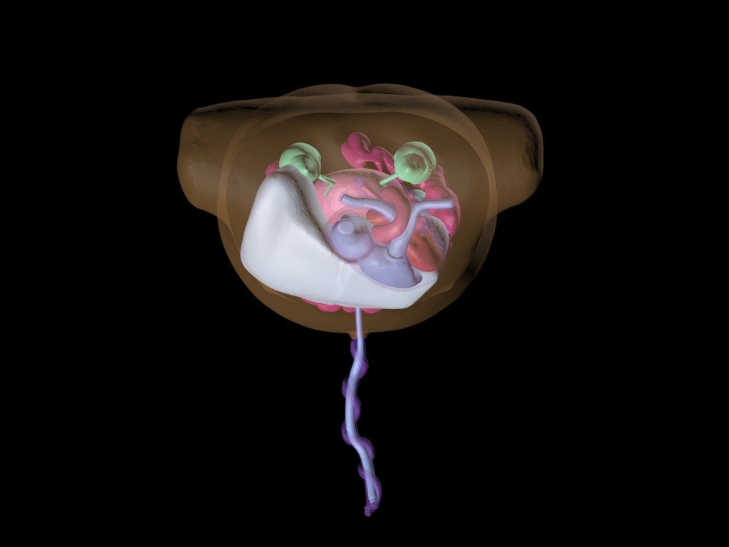 Newborn Torso (Advanced) for X-Ray CT, MRI