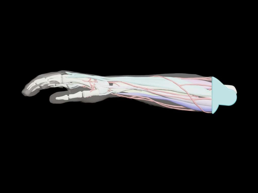 Adult Arm (Complex) for X-Ray CT, US, MRI