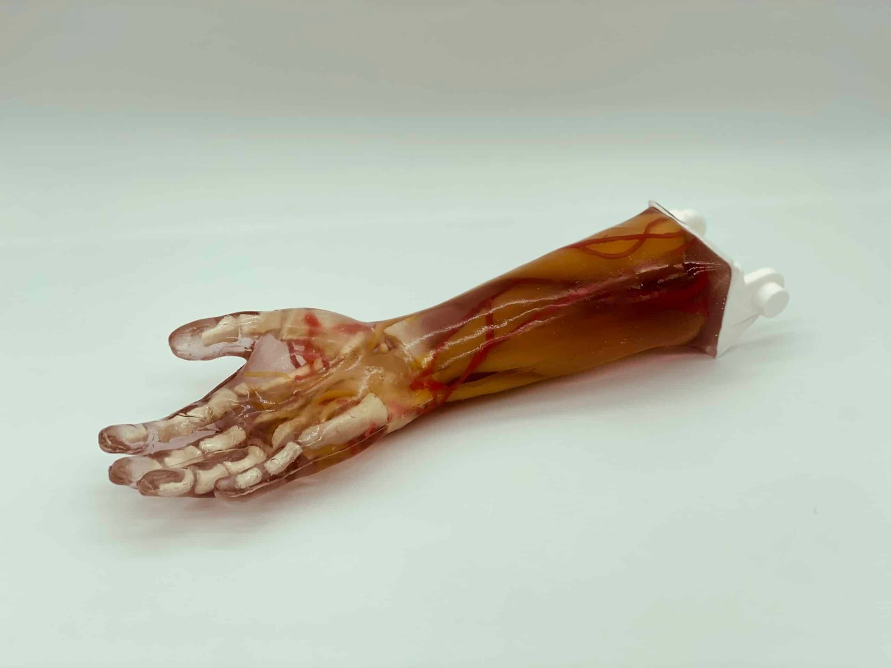 Adult Arm (Complex) for X-Ray CT, US, MRI