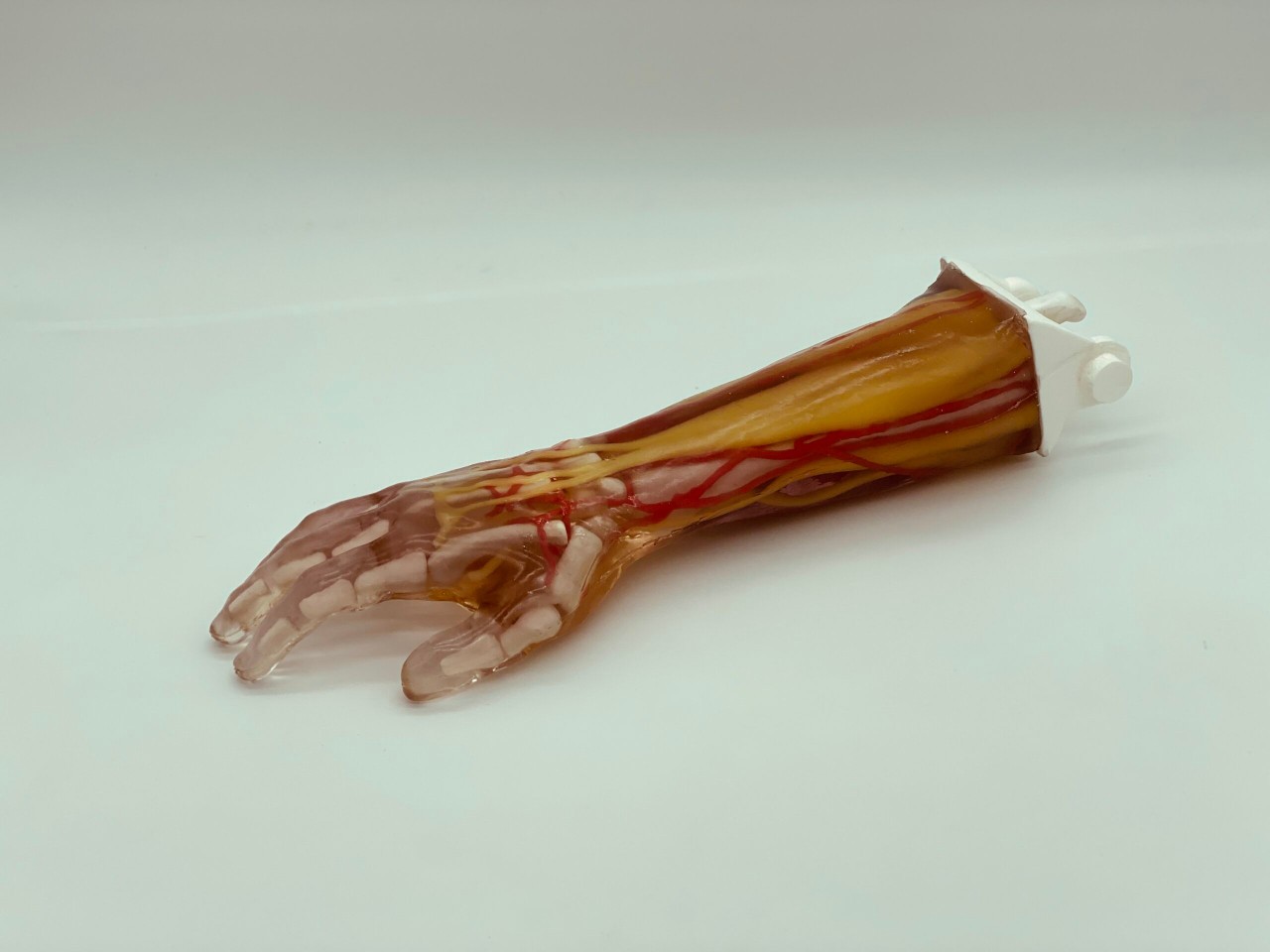 Adult Arm (Complex) for X-Ray CT, US, MRI