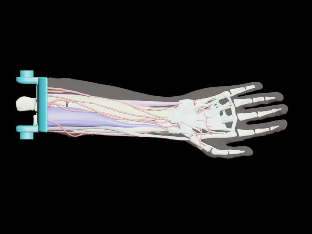 Adult Arm (Complex) for X-Ray CT, US, MRI