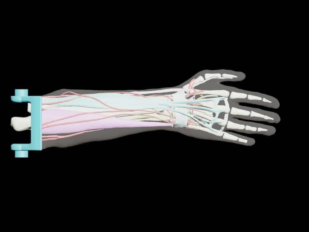 Adult Arm (Complex) for X-Ray CT, US, MRI