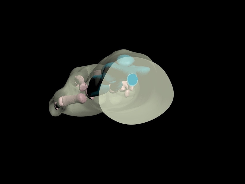 Adult Arm with Elbow for X-Ray CT, US, MRI