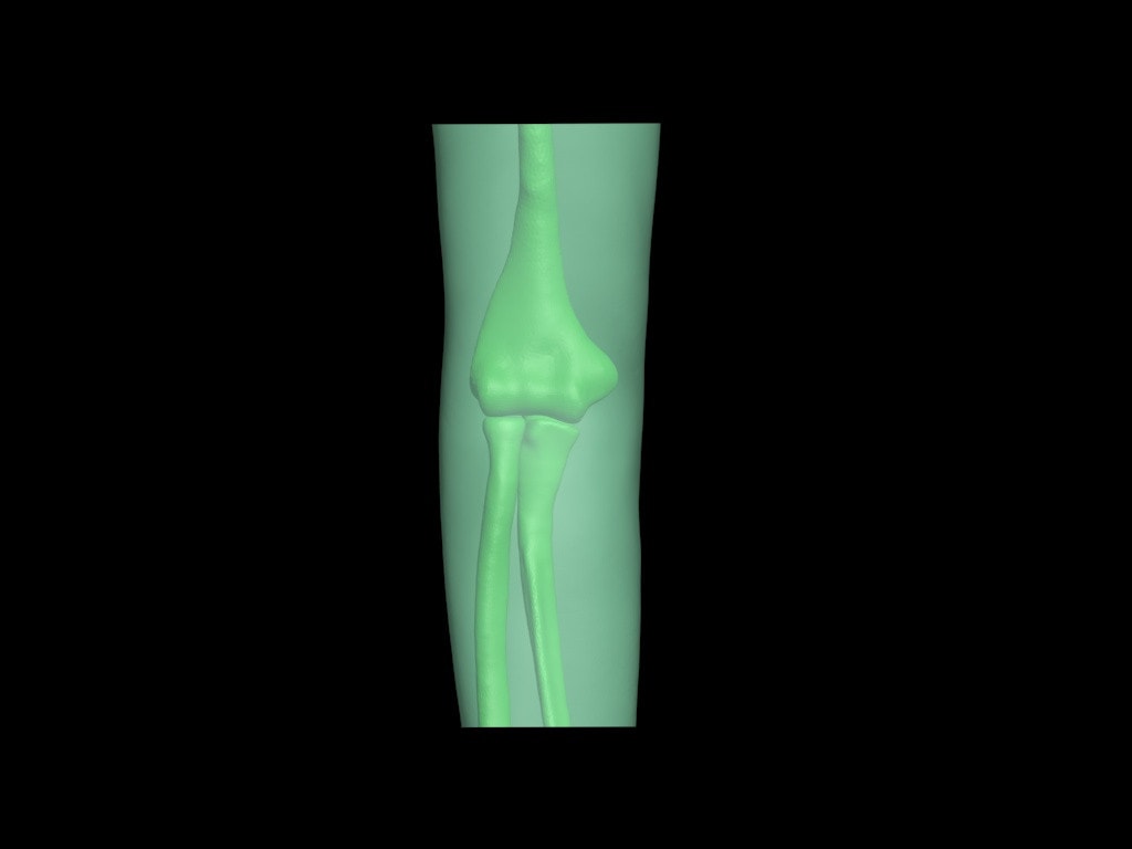 Adult Elbow for X-Ray CT, US, MRI - product design