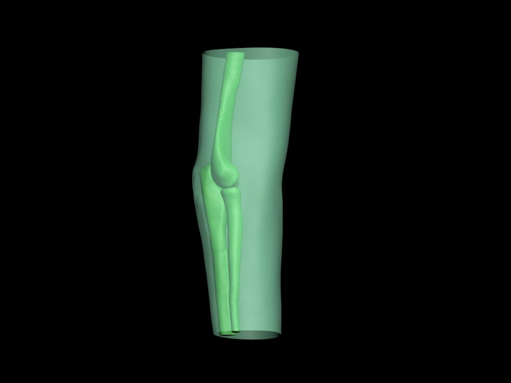 Adult Elbow for X-Ray CT, US, MRI - product design