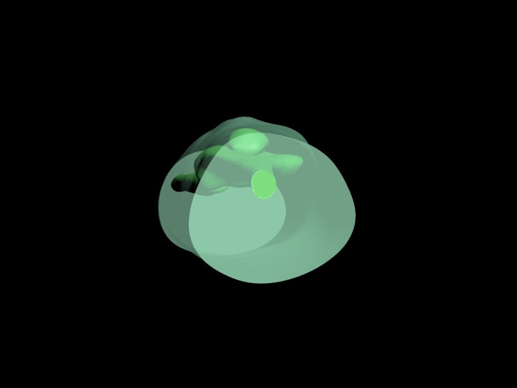 Adult Elbow for X-Ray CT, US, MRI - product design