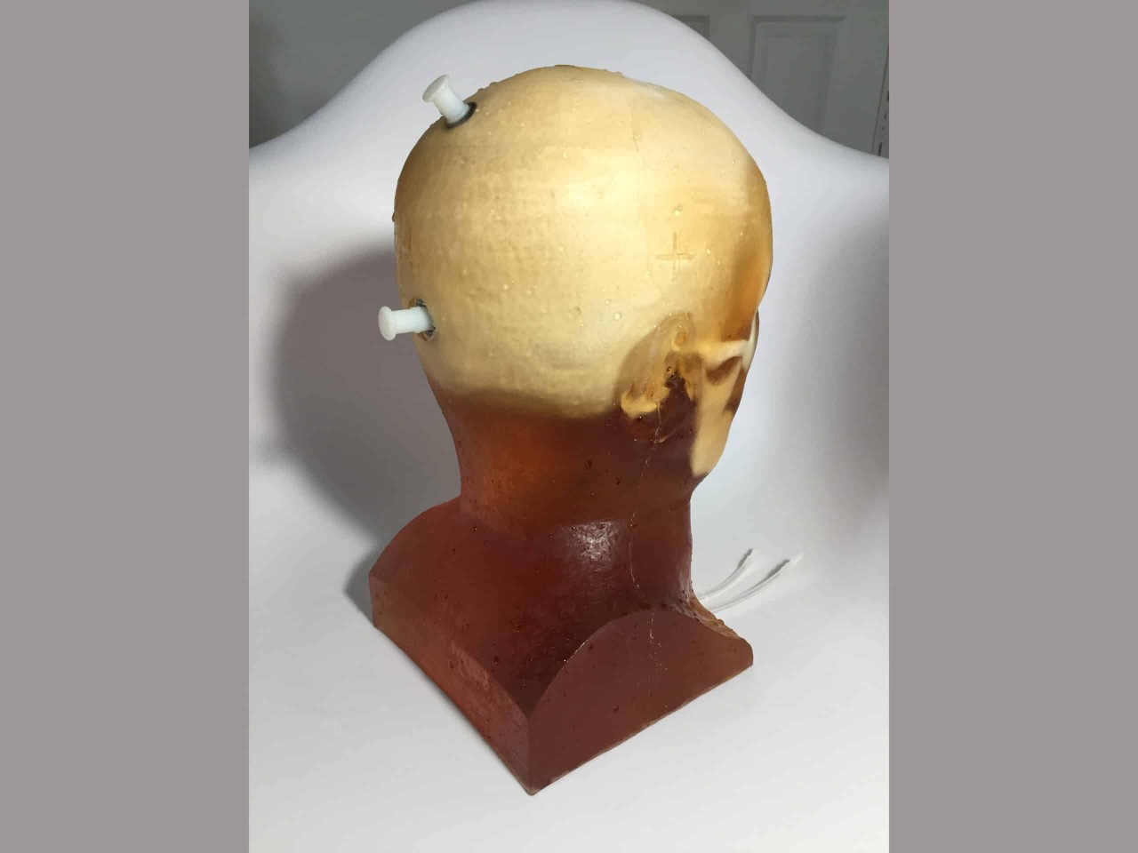 Adult Head (Hematoma) for X-Ray CT, US, MRI