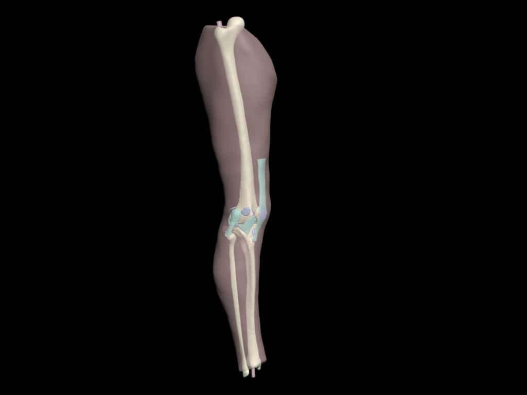 Adult Knee (Extended) for X-Ray CT, US