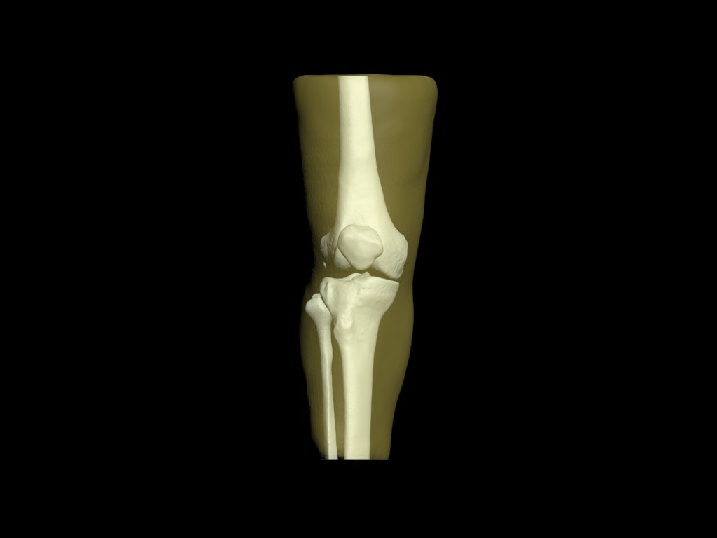 Adult Knee (Bones Only) for X-Ray CT, US, MRI