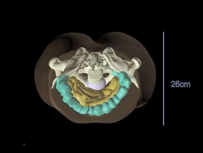 Adult Pelvis with Organs for X-Ray CT, MRI