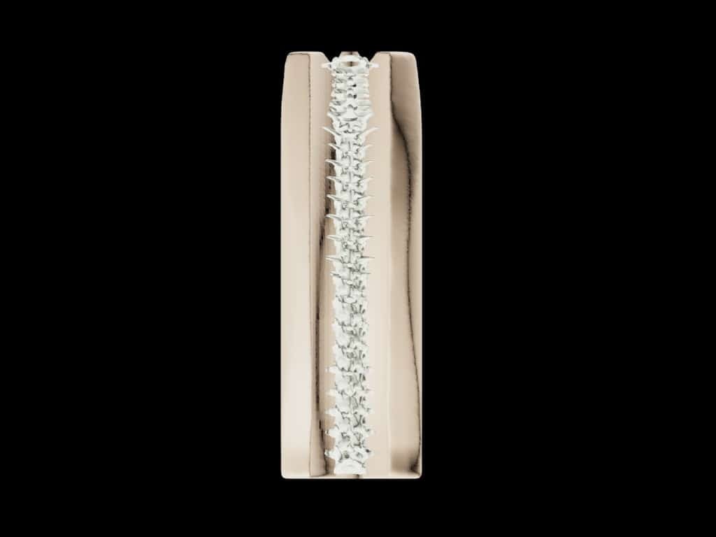 Adult Spine for X-Ray CT