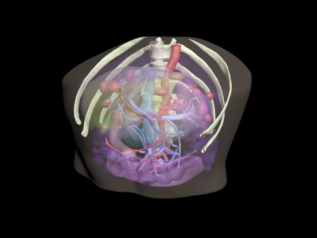 Adult Sectional Abdomen (Portable FAST Simulator) for X-Ray CT, US