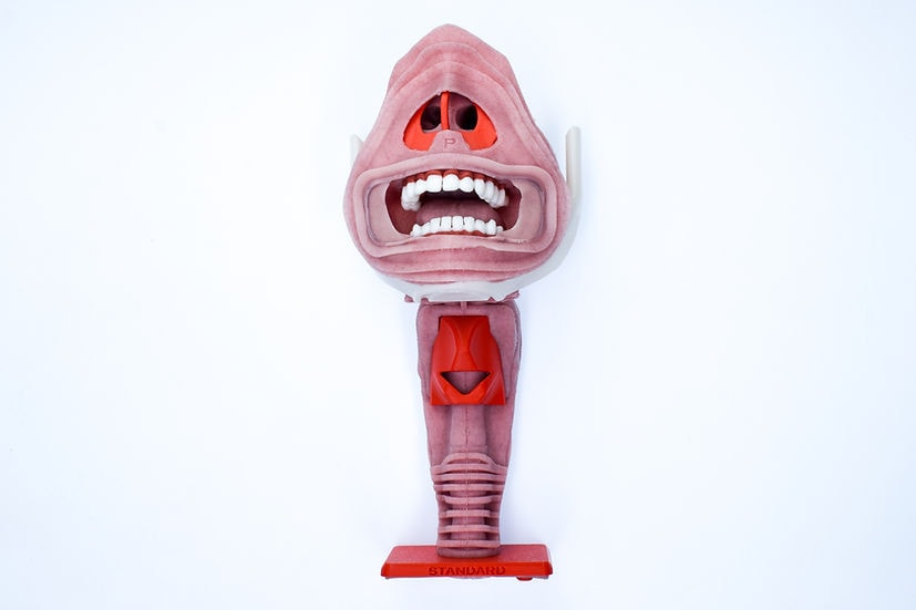 Difficult Airway - Angioedema