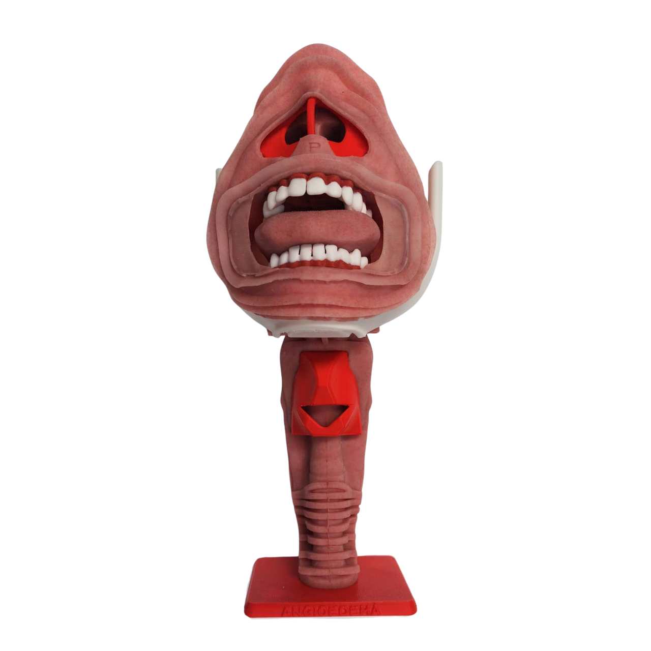 angioedema airway module