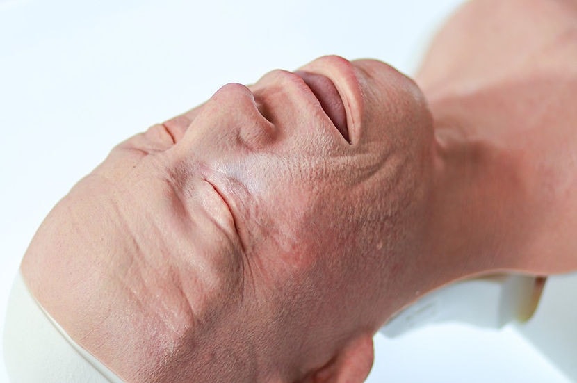 airway trainer with angioedema airway module