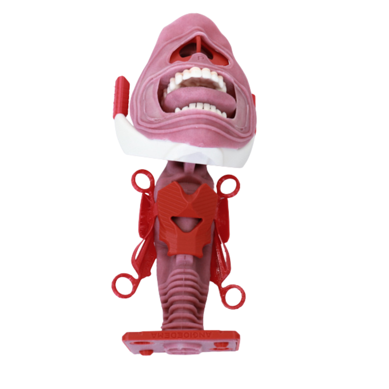 angioedema airway v2