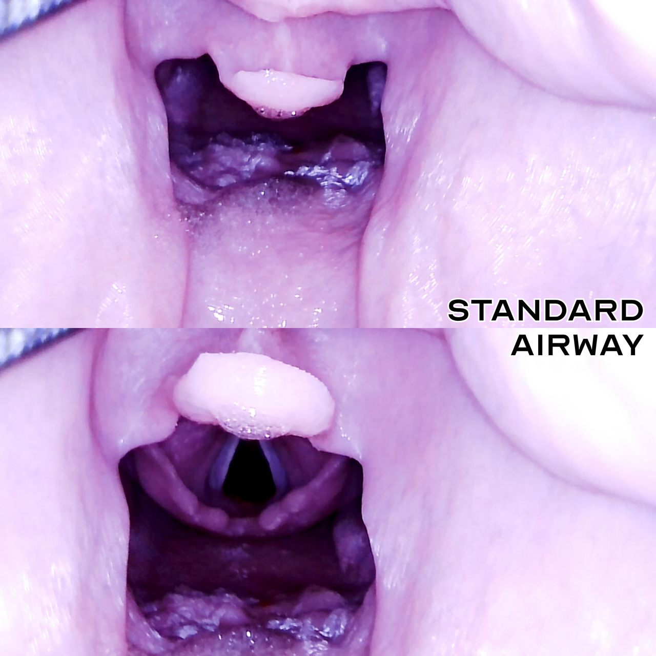 internal view of standard airway v2