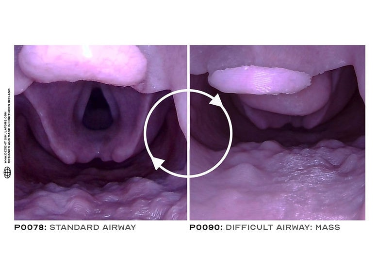 Mass/Tumor Difficult Airway Module for Airway Management Task Trainer V2