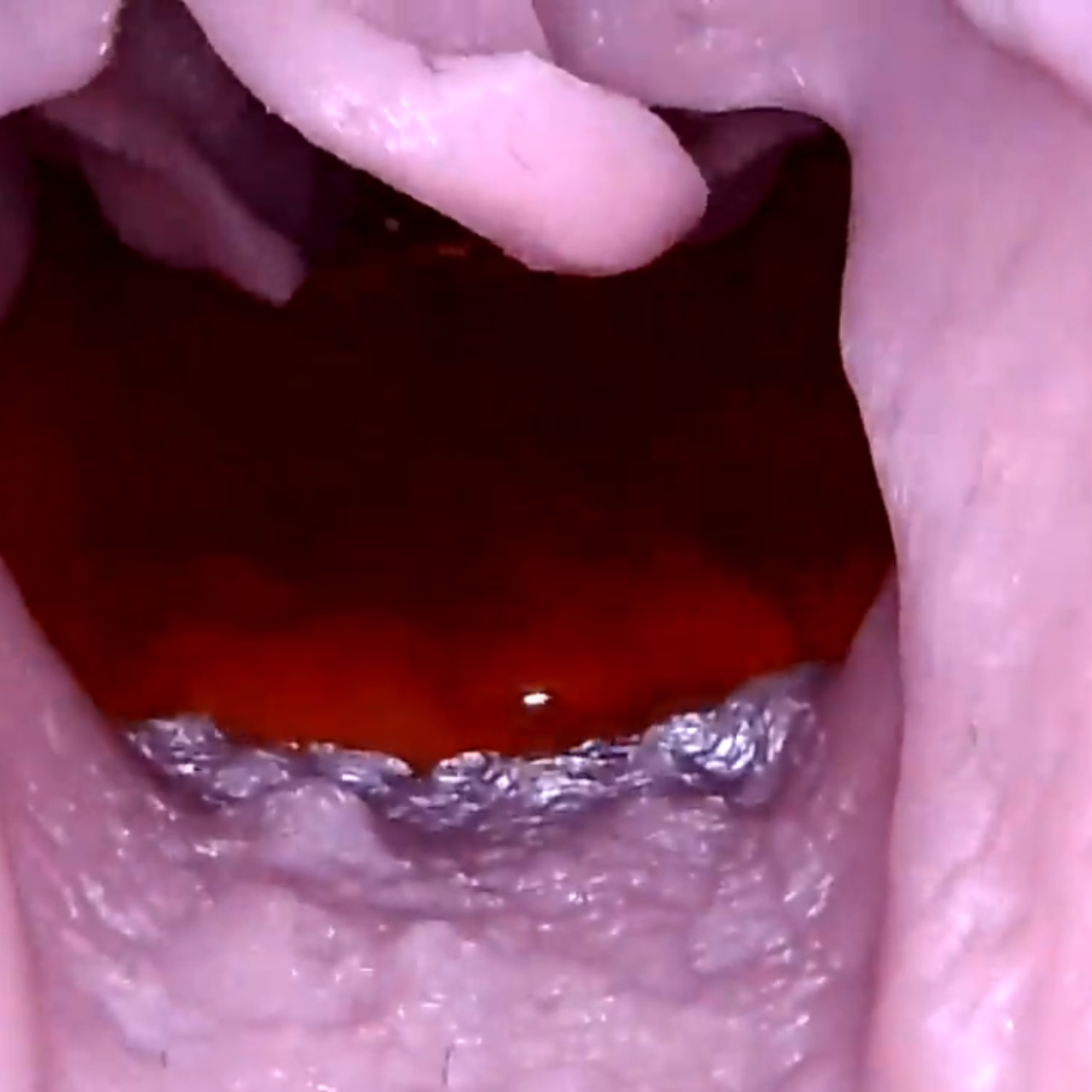 S.A.L.A.D. Module for Airway Management Task Trainer V2