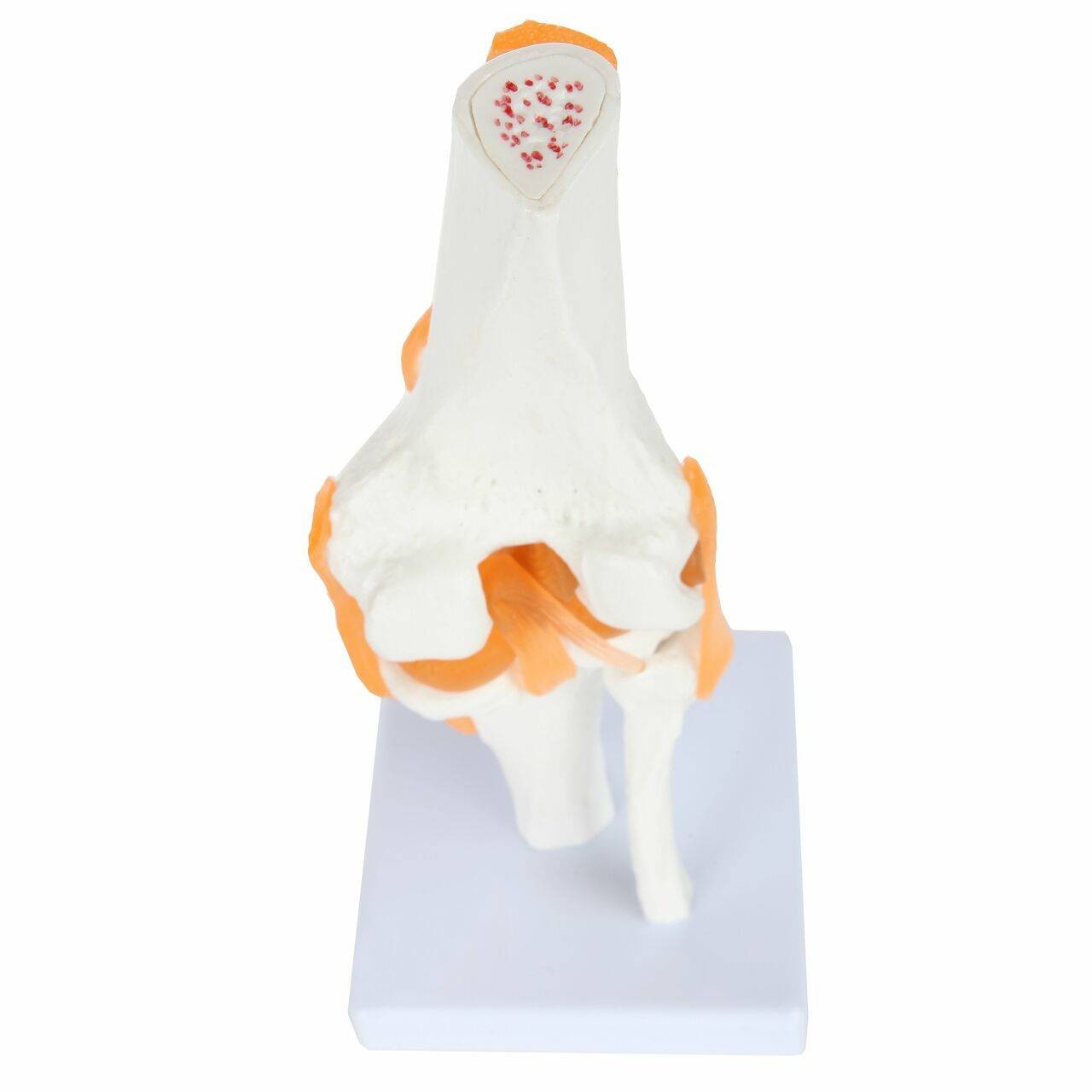 Axis Scientific Functional Knee Joint top view of of knee joint