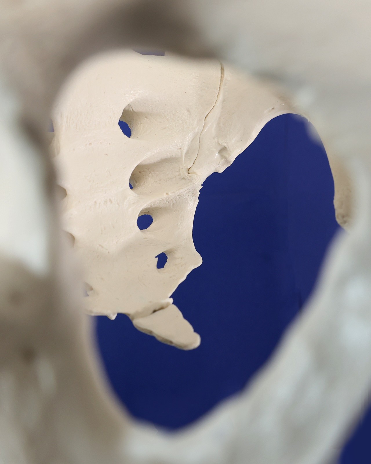 ラプンツェル様用】ATAVISM / PUTREFIED GENITALIA Vision