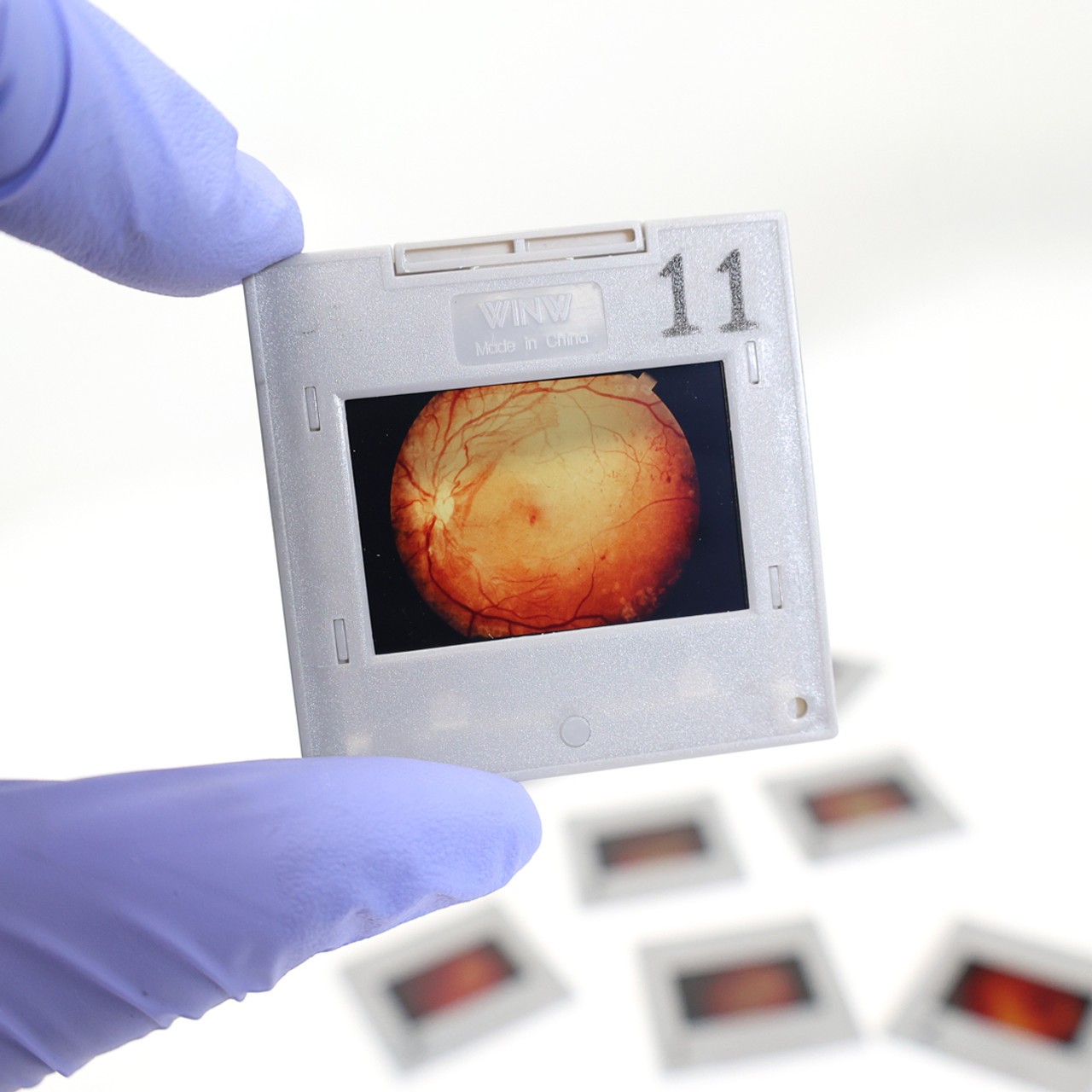 Anatomy Lab Eye Retinopathy Trainer