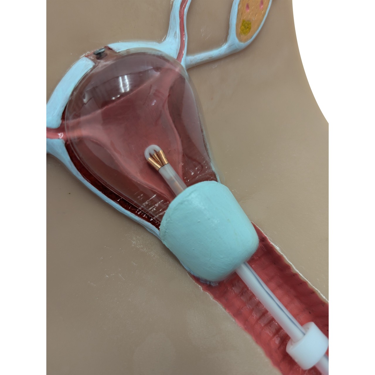 Anatomy Lab IUD Insertion Model