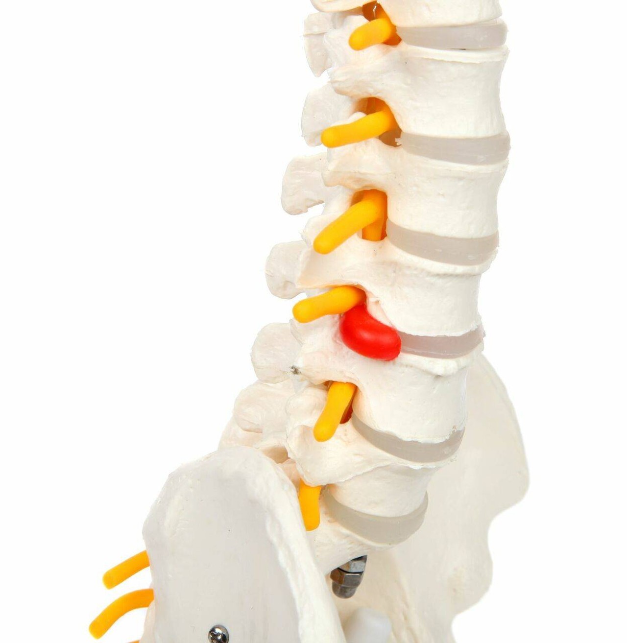 Axis Scientific Miniature Vertebral Column lumbar with simulated herniated disc