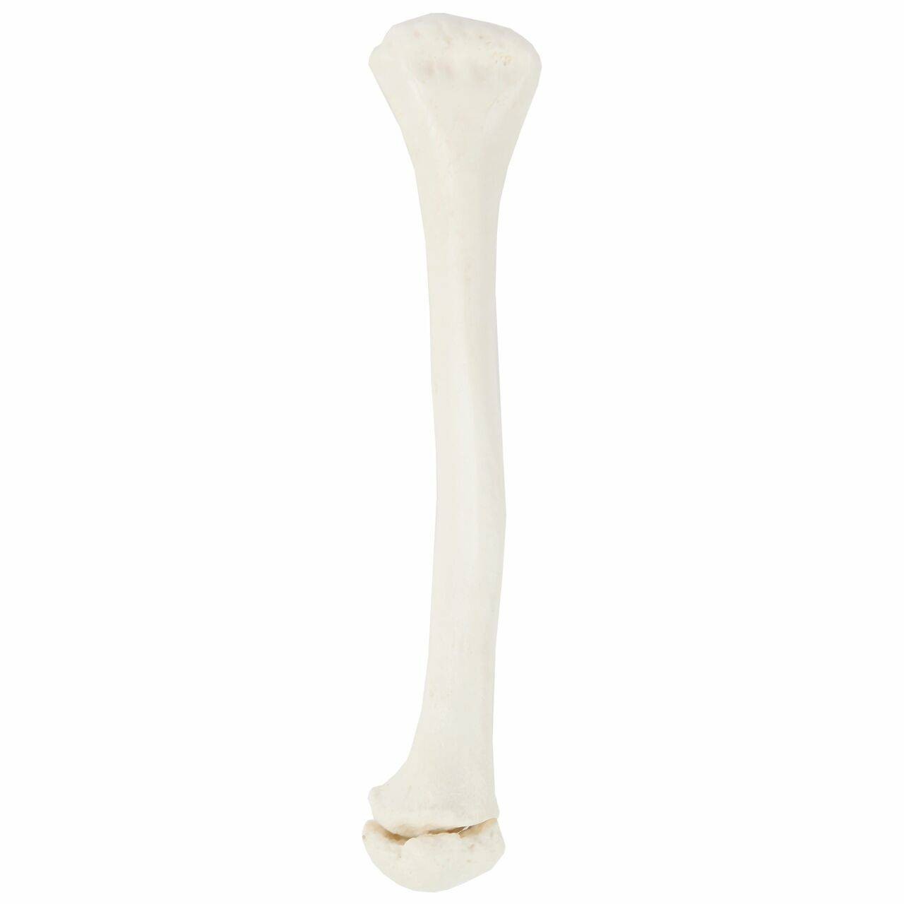 Axis Scientific Disarticulated Life-Size Half Child Skeleton Anatomy Model Disarticulated Arm