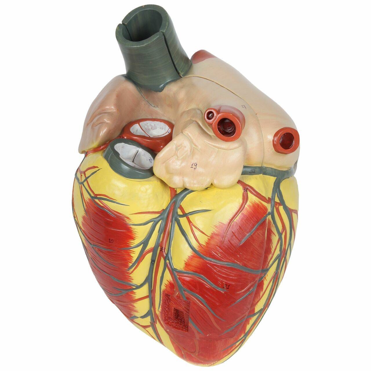 Axis Scientific 3x Life-Size 3-Part Human Heart Anatomy Model Back View
