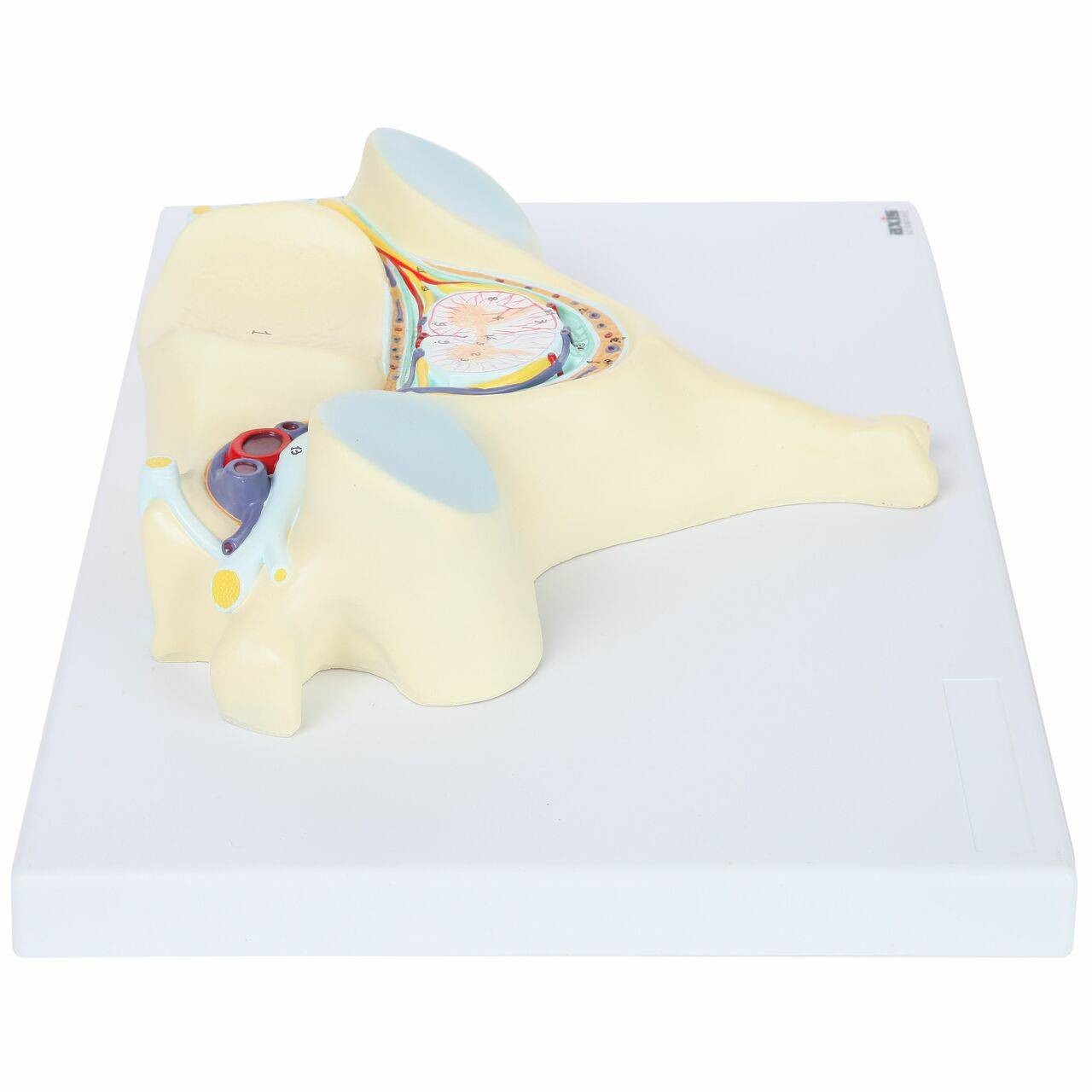Axis Scientific 5th Cervical Vertebra