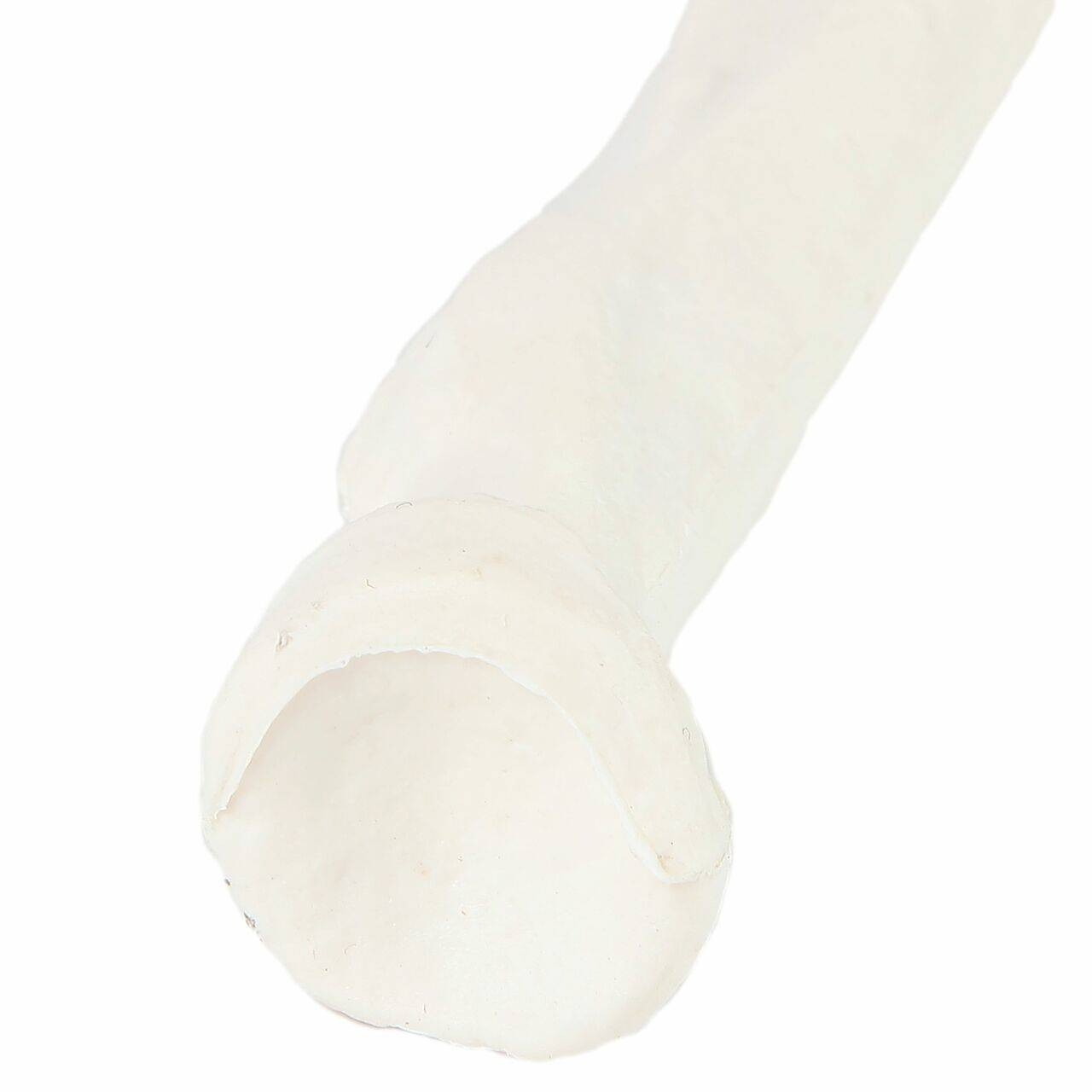 Axis Scientific Radius Bone