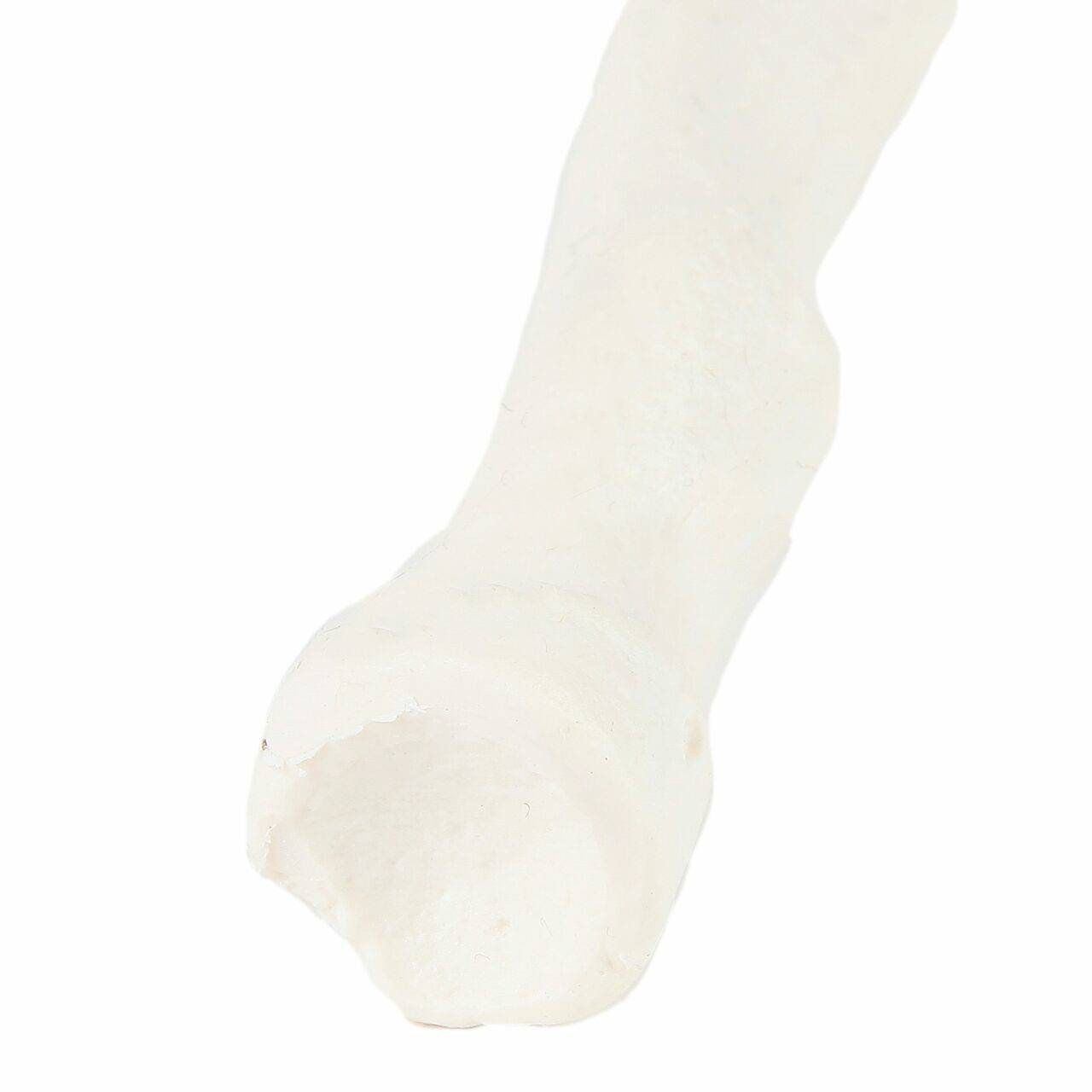 Axis Scientific Radius Bone