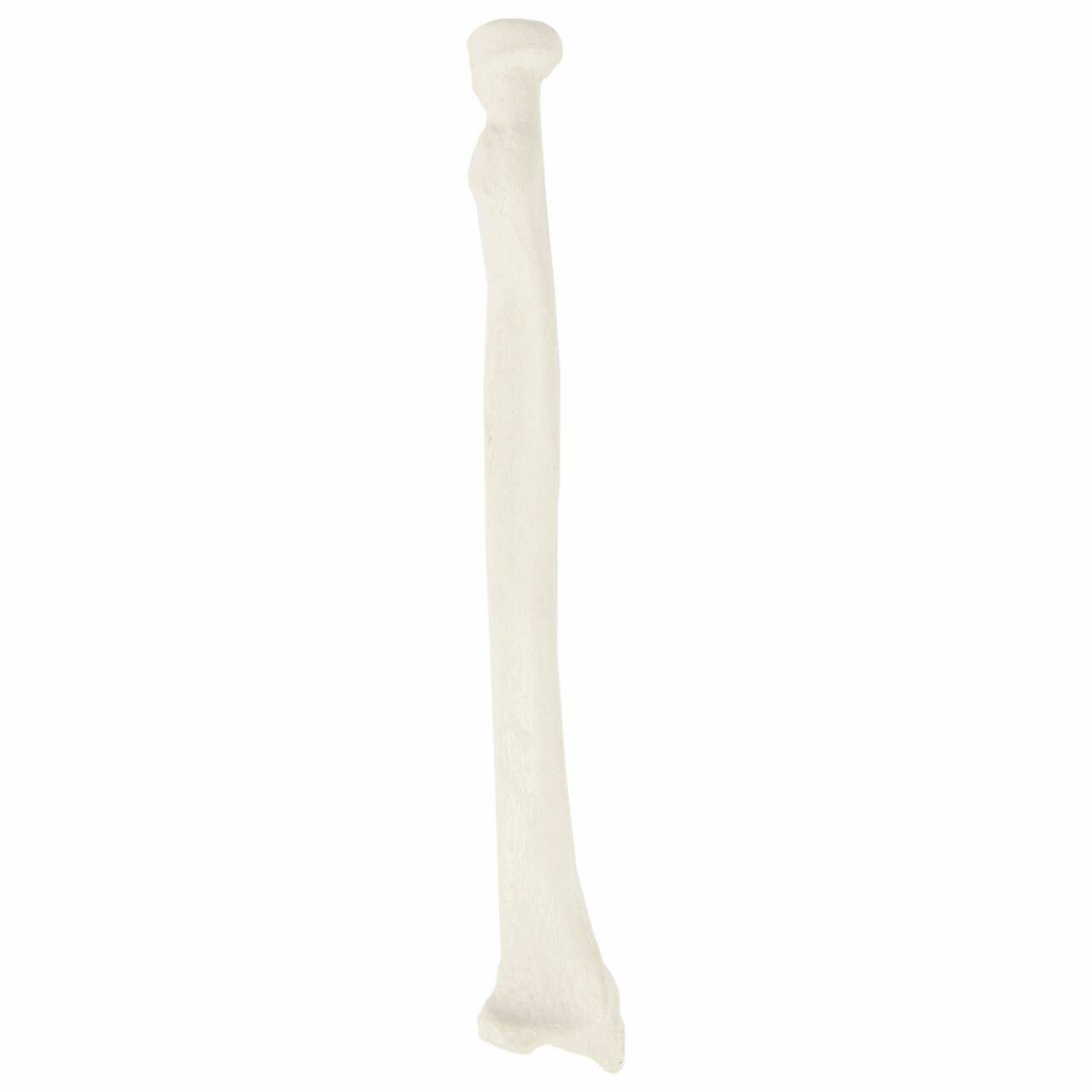 Axis Scientific Radius Bone
