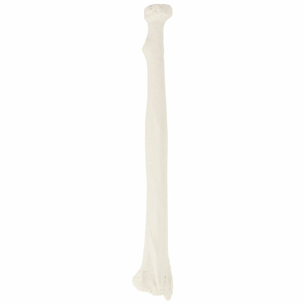 Axis Scientific Radius Bone