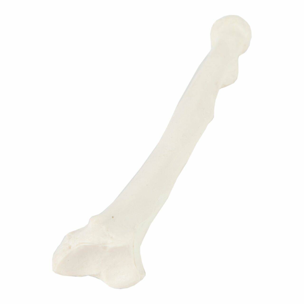 Axis Scientific Radius Bone