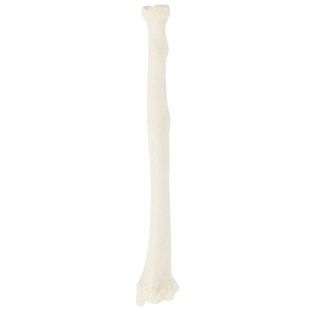 Axis Scientific Radius Bone