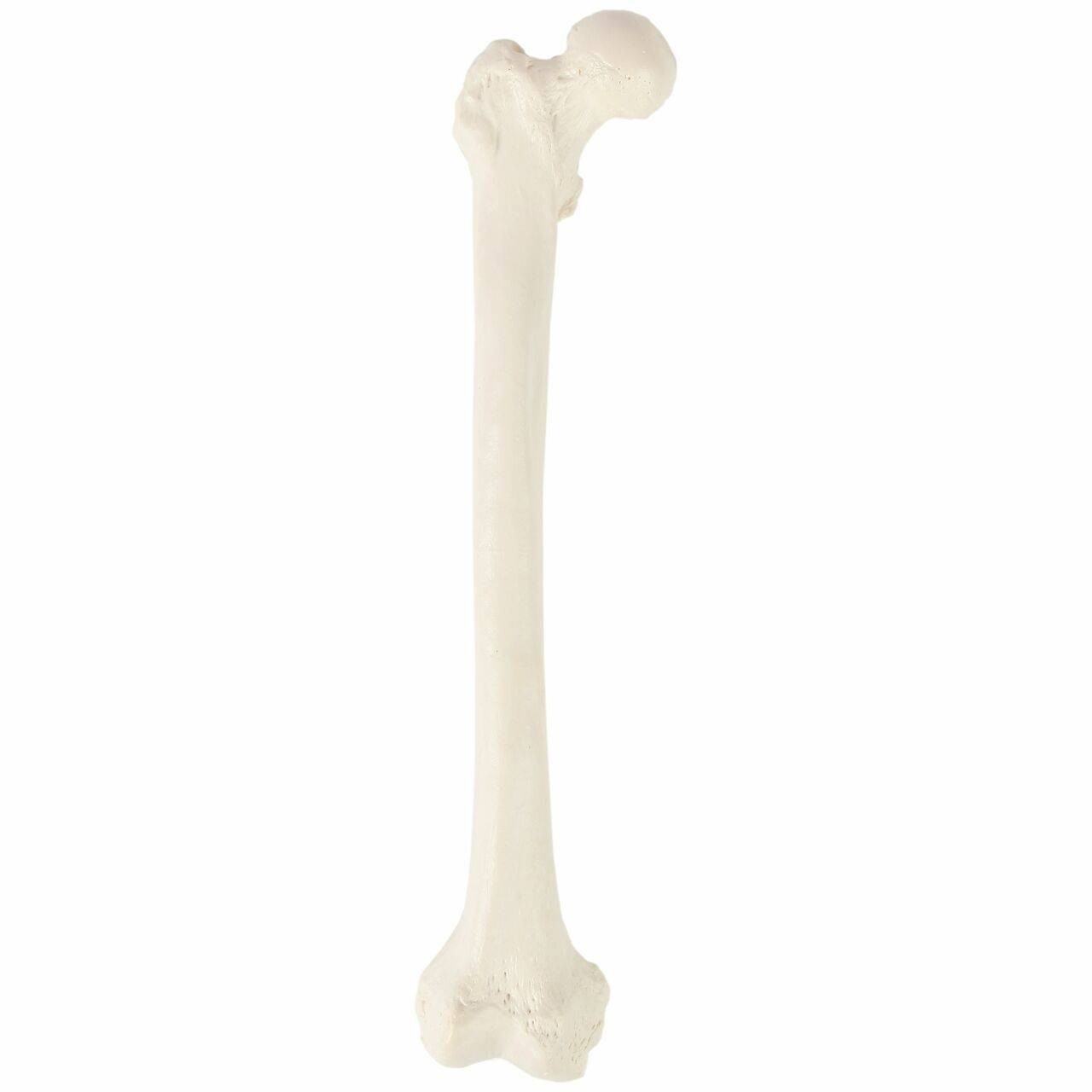 Axis Scientific Femur Bone | Anatomy Warehouse