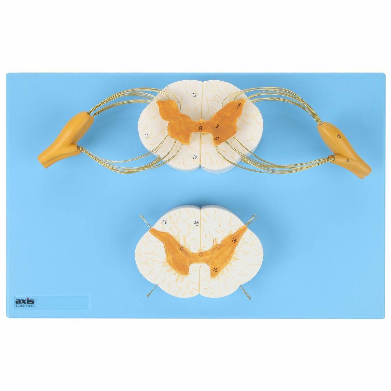 Axis Scientific Enlarged Spinal Cord Model with Nerves 8x Life Size