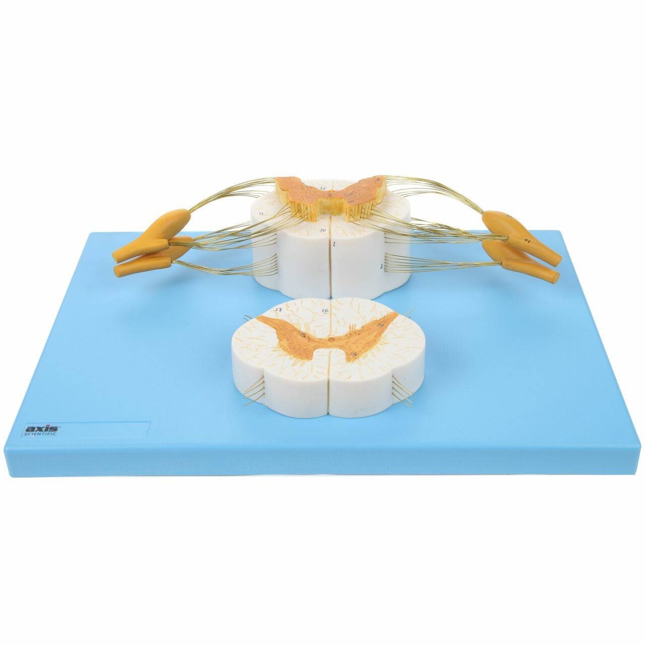 Axis Scientific Enlarged Spinal Cord Model with Nerves 8x Life Size