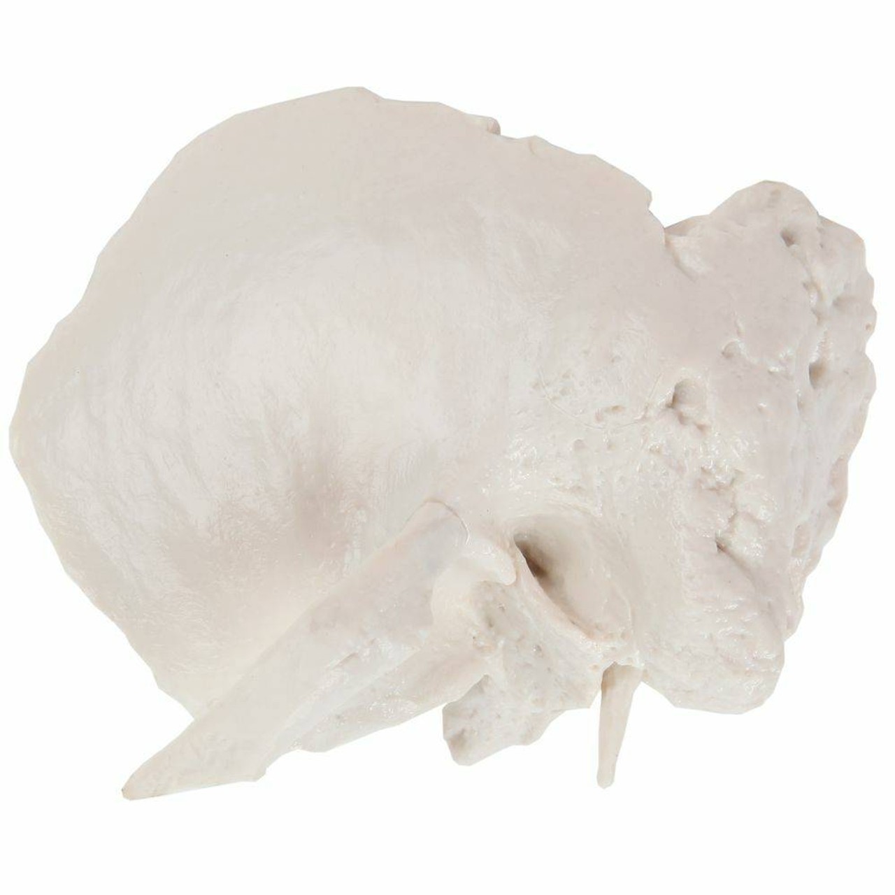 Axis Scientific Temporal Bone
